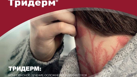 Создание презентации препарата Тридерм для компании Байер